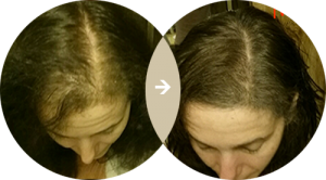 Hair Growth MD Results